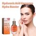 Hyaluronic Acid Serum, Moisturizing, Hydrating And Rejuvenating Facial Skin Care Serum_voghion.com