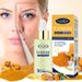 Curcumin Essence Hydrating, Brightening, Astringing Pores Face Serum_voghion.com
