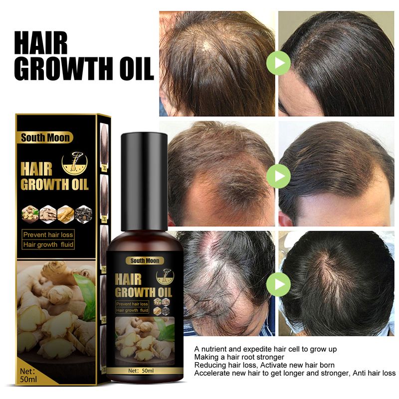 Haarwachstumsspray, Haarausfall-Serum-Behandlungsspray, feuchtigkeitsspendende Reparaturbehandlung, Haarwachstumsflüssigkeit, 50 ml. Dropshippin_voghion.com