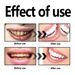 ORALHOE Yellow Stains Remove tartar, Fresh Breath, Oral Cleansing and Beautifying Teeth Powder_voghion.com