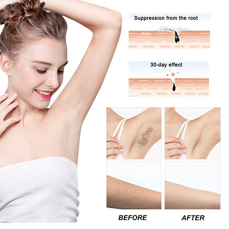 EELHOE Hair Removal Cream Gently quickly removes hair from the armpits, arms, body, providg smooth and moisturizg_voghion.com