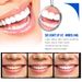 Whitening Jayswing Zahnessenz Mundreinigung & Zahnreparatur & Verfärbungsentferner Zahnvergilbung & Zahnsteinpflege Reinigung &_voghion.com