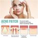 EELHOE Facial Mask Mild And Non Irritating Print Healing Acne Facial Repair Patch_voghion.com