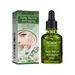 EELHOE Deep Anti-Wrinkle Serum, Facial Firming Reduces Fine Lines And Wrinkles, Shrinks Pores And Improves Skin_voghion.com