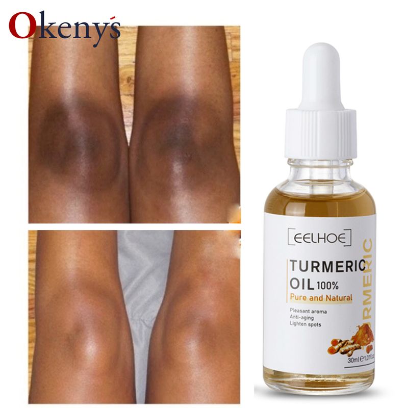 Lemon Oil Turmeric Skin Glow To Lightening Acne Dark Patches, Acne Bright Skin Dark Spot Corrector Face Whitening S_voghion.com