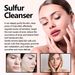 EELHOE Sulphur Facial puhdistaa ihohuokoset hellävaraisesti, kuorii, ei tiivistä, kosteuttaa ja ravitsee ihoa_voghion.com