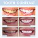 Tooth West&Month 7-Day Whitening and Cleaning Tooth Stains, Yellow Teeth, Stains Stains, and Whitening Oral Care_voghion.com