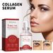EELHOE Collagen Serum, Fade Facial Fine Lines, Firming Skin Deep Moisturizing And Hydrating Essence_voghion.com