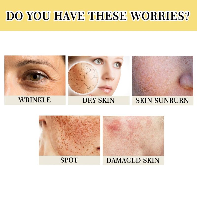 Snail Moisturizes 96 OUHOE Barrier Snail And Desalinates Spot Power Skin Essence Collagen Essence Black Repairs_voghion.com