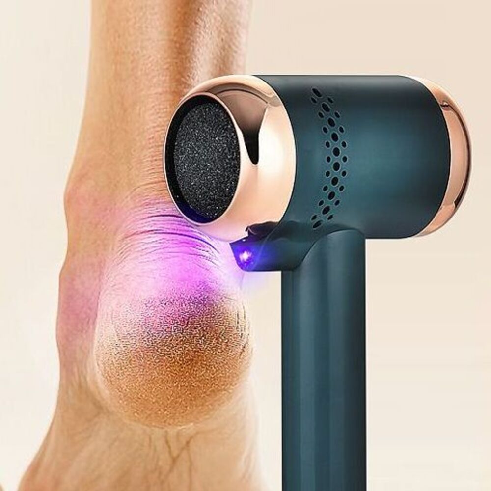 Lima elettrica ricaricabile per la rimozione dei calli, strumento magico per la cura dei piedi a casa_voghion.com