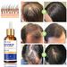 IBeaLee Hair Growth Liquid stärker återfuktar rötter, förbättrar näring, förhindrar förlust, stelnar hår och orsakar_voghion.com