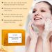 OUHOE Turmeric & Kojic Soap, Gentle Cleansing Skin Moisturizing Facial Body Care Soap_voghion.com
