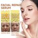 EELHOE Face Repair essence Anti aging Firming Facial Skin Lightening Fine Lines and Wrinkles_voghion.com