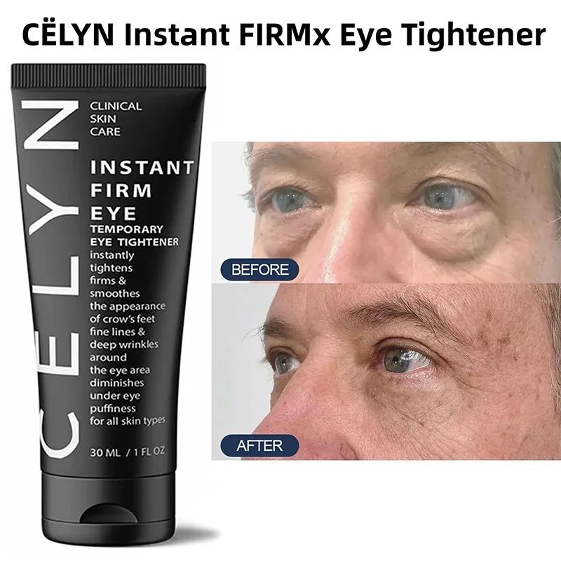 Cëlyn Make Up Eye Firmer Eye Lift Firm Eye Bag Removal Wrinkle Removal Eye Care Eye Cream Remover Dark Circle Eye Pouches_voghion.com