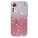 Bling Glitter Bloem Case Voor Xiaomi Redmi Note 12 12S 11 11S 10S 10 Pro Max Plus turbo Prime 12C 10C 11A Plating Soft Cover_voghion.com