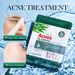 SADOER Tea Tree and Oil Control Print Student Skin Care Product Moisturizing Anti Acne Tablet facial mask_voghion.com