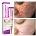 Beauty Care shop Freckle Niacinamide Whitening Cream Remove Melasma Fade Melanin Dark Spots Pigmentation Moisturizing Brighteni_voghion.com