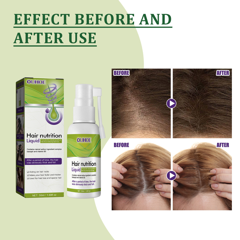 OUHOE Growth Pump Solution Nourishing Scalp, Dense Strong Anti Broken Hair, Sparse and Fixed Hair Nutrition Liquid_voghion.com