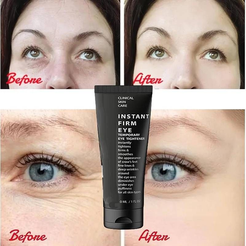 CËLYN Krem pod oczy Instant Firm Liftingujący worki pod oczami Usuwanie zmarszczek Usuwanie cieni pod oczami Pielęgnacja skóry oczu Oryginalna 30 ml_voghion.com