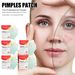 Jaysuing Acne Patch Series Acne Skin Balance Skin Acne Patch_voghion.com