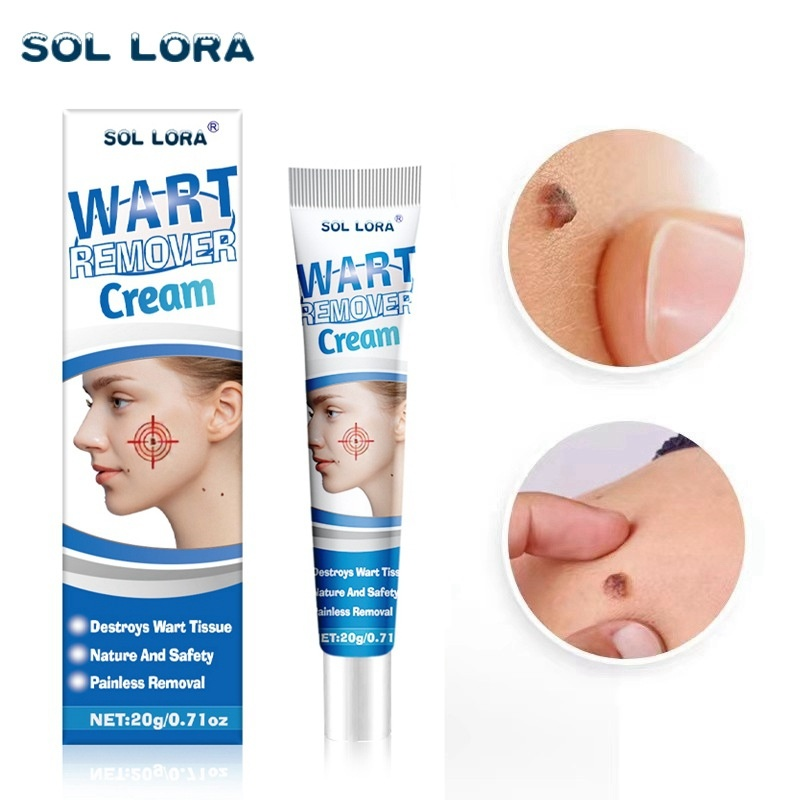 SOL LORA Yama Flat Removal Filamentous Wart Chicken Eye Spot Naevus Cream_voghion.com