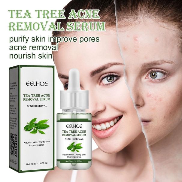 Ορός Προσώπου για Θεραπεία Ακμής Ενυδατικό Έλαιο Τεϊόδεντρου Συρρίκνωση Πόρων Ορός Προσώπου για Ακμή Κορεάτικα Προϊόντα Περιποίησης Δέρματος_voghion.com