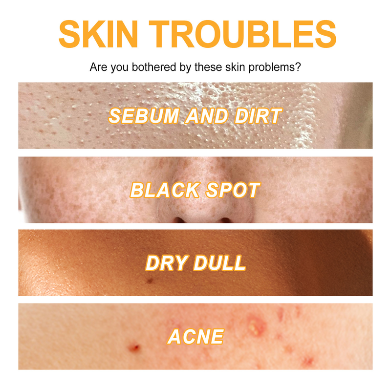 EELHOE Exfoliating Deep Cleansing Acne Removing Blackhead Moisturizing Skin Shrinking Pore Brightening gel_voghion.com