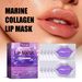Moisturizing Mask To Lighten Lip Lines, Remove Dead Skin, Prevent Dry Cracks, Moisturize, Smooth, And Plump Lips Care_voghion.com