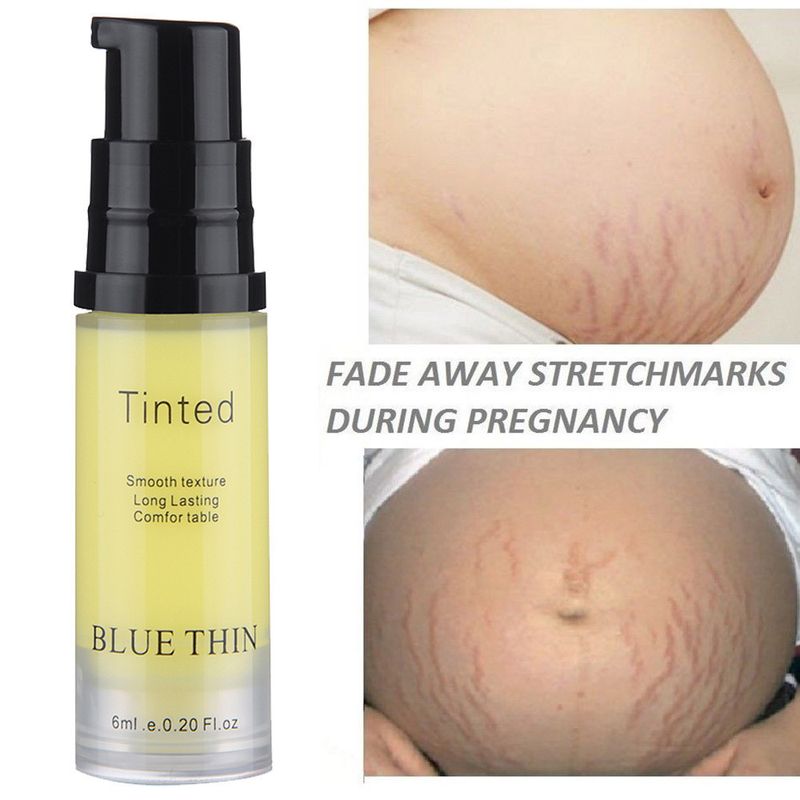 QLZHANFU Nieuwe Litteken Striae Crème Reparatie crème Verwijdering Acne Litteken Striae Crème Vet Litteken Striae Gravidarum Behandeling Lichaamscrèmes_voghion.com