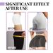 lifting, Beautiful hip lifting beautiful buttocks, peach buttocks, highlighting body shape, shaping buttocks, lifting_voghion.com