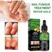 repair Beautiful nail solution, hand and foot nail care solution, repairing gray nails, shining nails, soft nails, s,_voghion.com