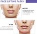 EELHOE Lift Mask: Face Lift, Tighten, Tighten Chin, Fade Fine Lines, Shape V-shaped Melon Seed Face Mask_voghion.com