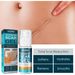 QLZHANFU Advanced Scar Removal Cream Acne Pimples Stretch Marks Repair Gel Burn Surgical Scar Treatment Smoothing Body Beauty Skin Care_voghion.com