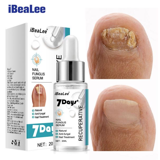 Special Antibacterial Nail Removal Cream Thickening Soft Nails, And Special Solution For Gray Nails_voghion.com