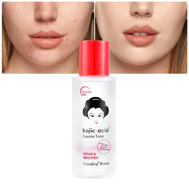GuanJing Qu Acid Toner Brightens, Softens, and Moisturizes Skin Care Water Brand Tone_voghion.com