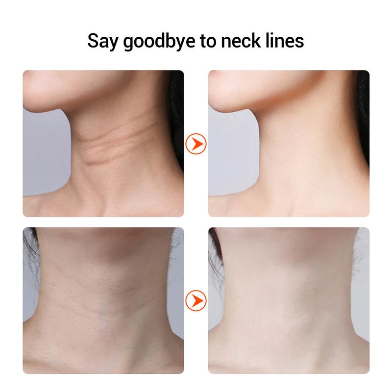 Hot Three Level Adjustable Constant Temperature With Micro Current Face Dual-purpose Neck Removal And Facial Wrinkle_voghion.com