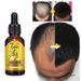 Ginger 24ss  Growth Lotion for Nourishing Improving Hair Care, Moisturizing and Preventing Nutrient Loss_voghion.com