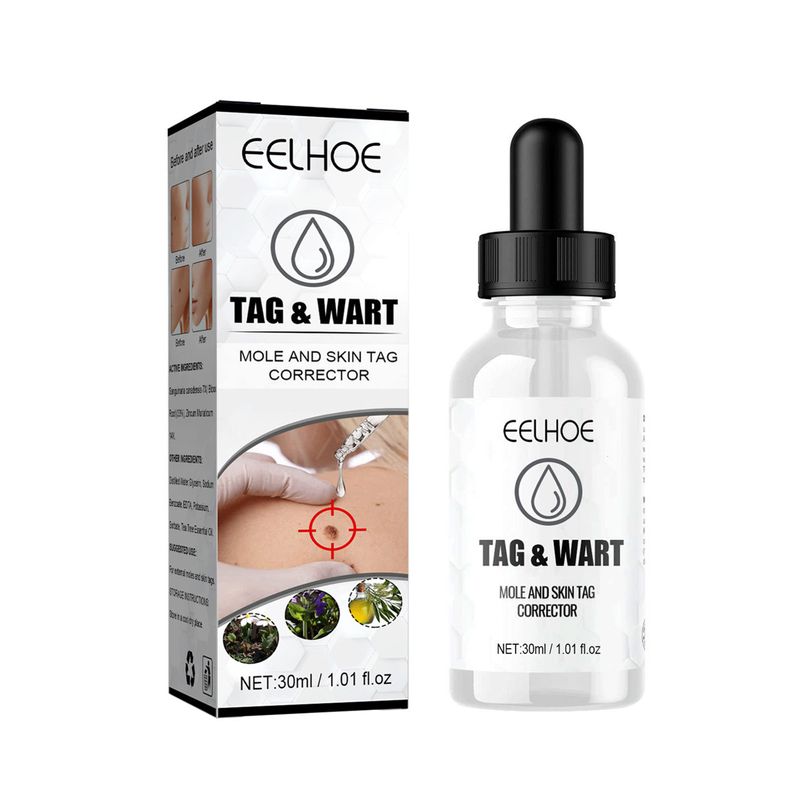 BeautyLife 30 ml Warzenentferner-Flüssigkeit, universell, natürlich, schnelle Wirkung, hellt Melanin schmerzlos auf, korrigiert Hautflecken und Hautflecken, Essenz für das Gesicht_voghion.com