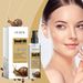 Ouhoe Snail Brightening Essence Surface Hydrating, Moisturizing, Firming, Brightening And Rejuvenating Serum_voghion.com