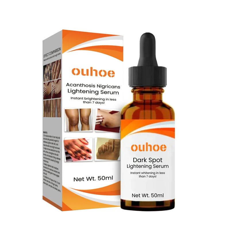 Körperaufhellungsserum, Melanin aufhellen, dunkle Knöchel aufhellen, Achseln, Knie, Ellenbogen, innere Oberschenkel, Nikotinamid, dunkle Flecken, Schönheitspflege_voghion.com