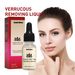 Anti Mole pour un nettoyage en profondeur de la peau, élimination des verrues, dessalinisation des grains de beauté noirs, réparation et lissage_voghion.com