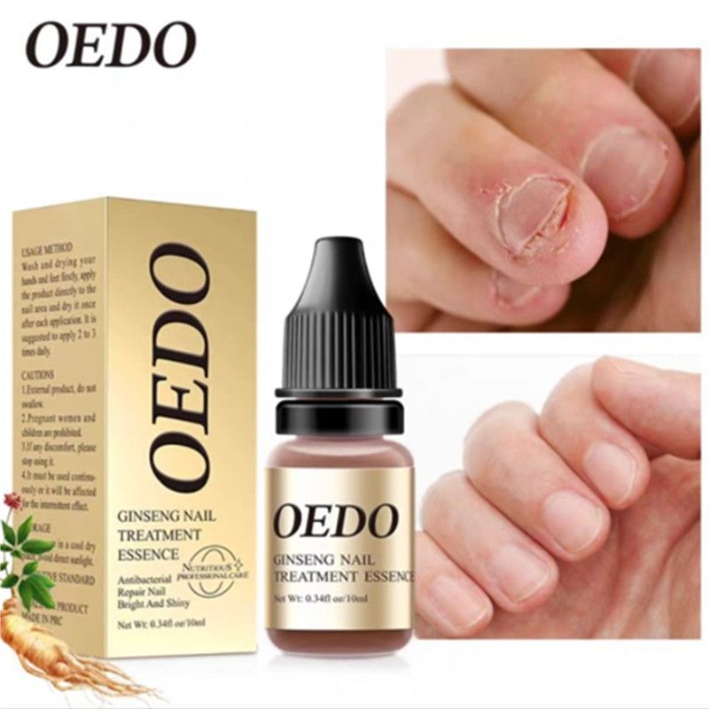 BeautyLife OEDO Traitement des Ongles Essence Huile Hydratante Elimination des Champignons Liquide de Soin des Pieds_voghion.com