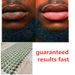 1pcs lip whitening cream with pink freshening treatment removes smoky lip oil_voghion.com