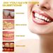 Oralhoe Propolis Pulizia orale Cura delle macchie dei denti Dentifricio in mousse fresca_voghion.com