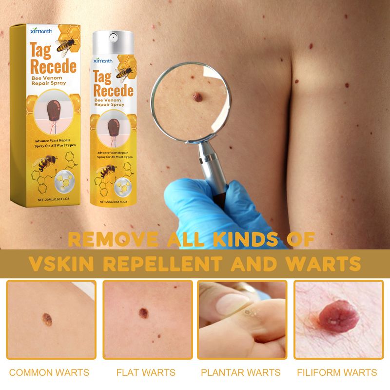 Ximonth Beesvenom Wart Care Spray, Improves Flesh Particle Mole Repair Smooth Skin Wart Treatment Spray_voghion.com