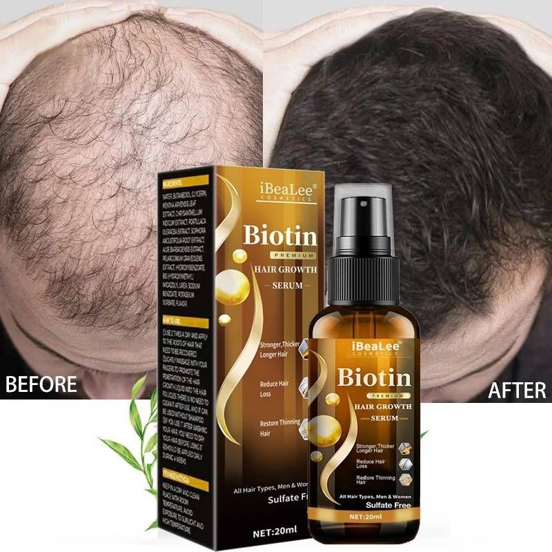 20 ml serum za rast las, pršilo za rast las z biotinom, serum za rast las za gostejše, daljše in močnejše lase_voghion.com