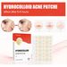 Hydrocolloid Acne Invisible Makeup Closed Mouth Acne Patch Clean Acne Waterproof Breathable Acne Muscle Repair Patch Female Male_voghion.com