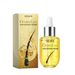 EELHOE Scalp Hair Care Essence_voghion.com