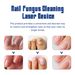 Nail for repairing thickening gray nails, relieving ingrained nails in toenails, cleaning and care device_voghion.com