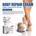 Moon South Urea Hand Foot Repair Cream Relieves Peeling, Improves Dryness, Removes Dead Skin, And Moisturizes The Skin Peeling, Dryness, ,_voghion.com